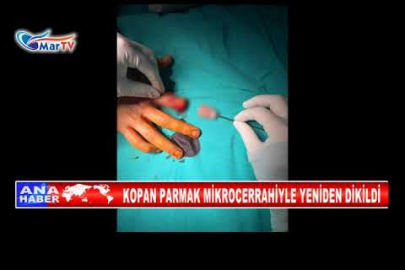 KOPAN PARMAK MİKROCERRAHİYLE YENİDEN DİKİLDİ
